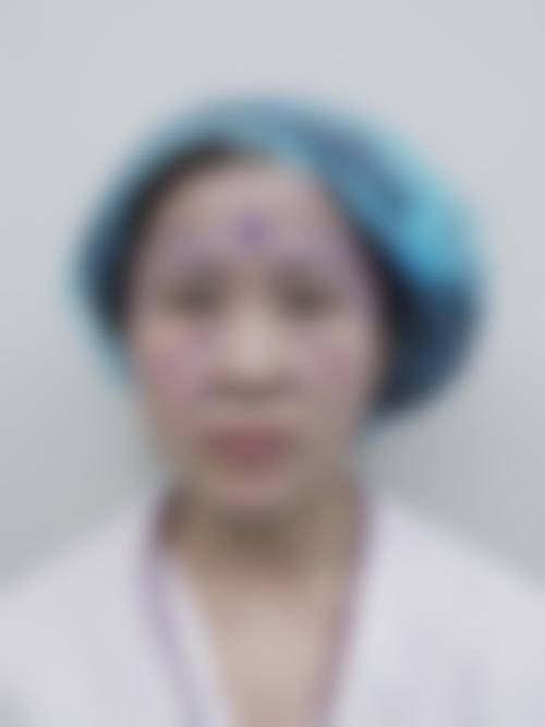 FAQ:常见问题解答