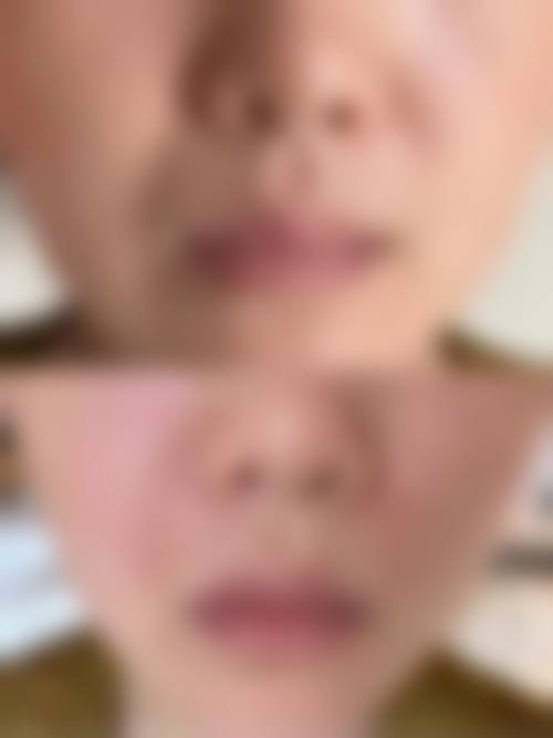 临床实例分享