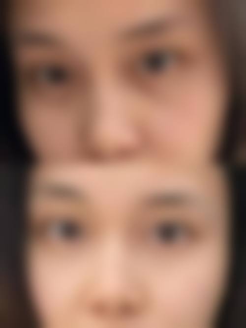 擅长项目详解:张大力医生的特色技术