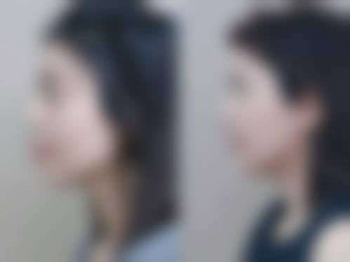 价格明细与优惠活动