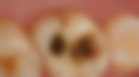 临床实例分享