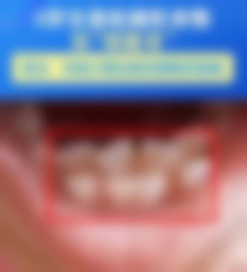 擅长项目详解