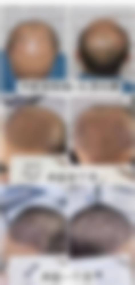 擅长项目详解:王宣医生的核心技术领域