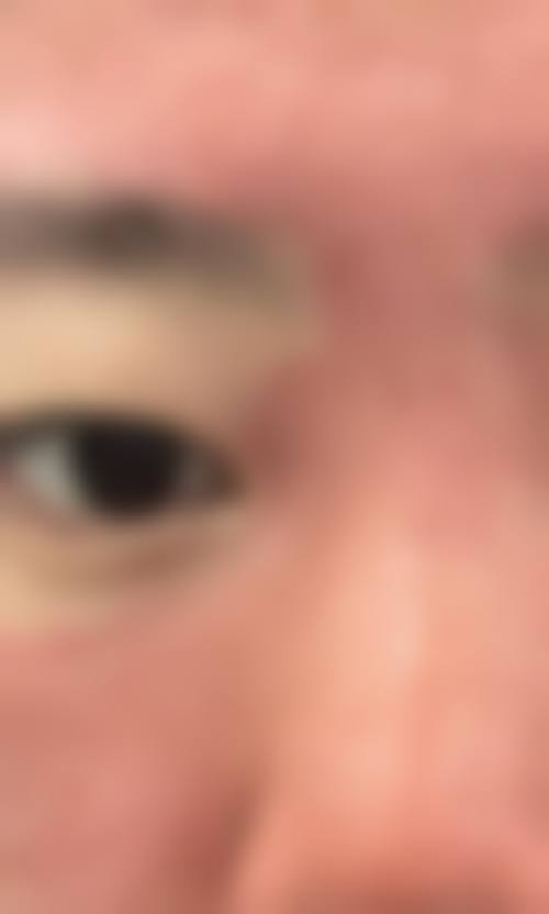 临床实例分享
