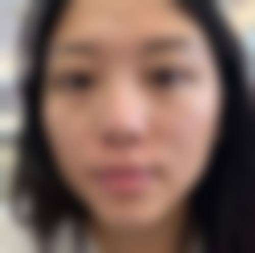 擅长项目详解:精细定制美丽方案