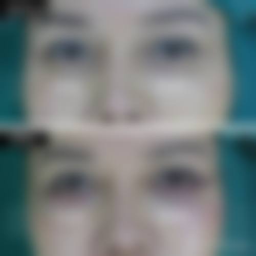 预约优惠活动:限时补贴不容错过