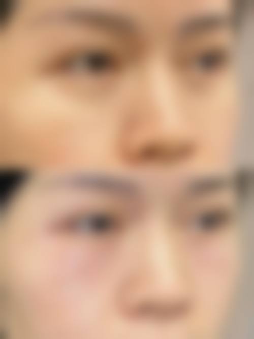 擅长项目详解:精细解决皮肤困扰