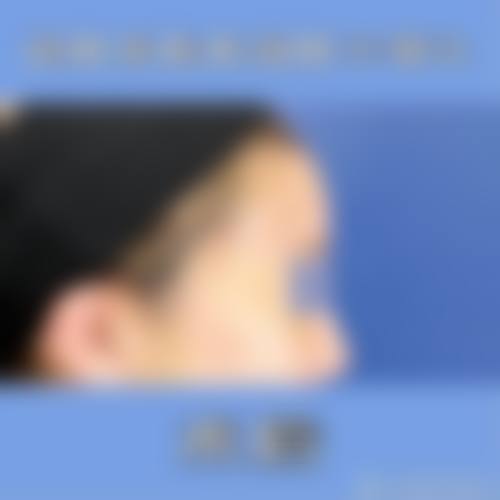 预约优惠活动