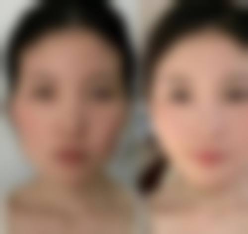 临床实例分享:真实改变看得见