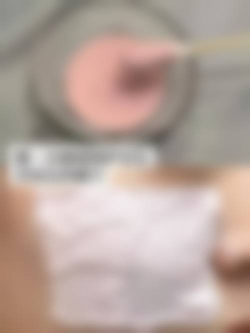 临床实例分享