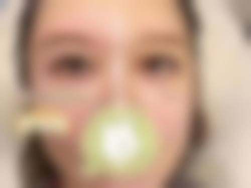患者真实评价芭比亚沙维亚医生