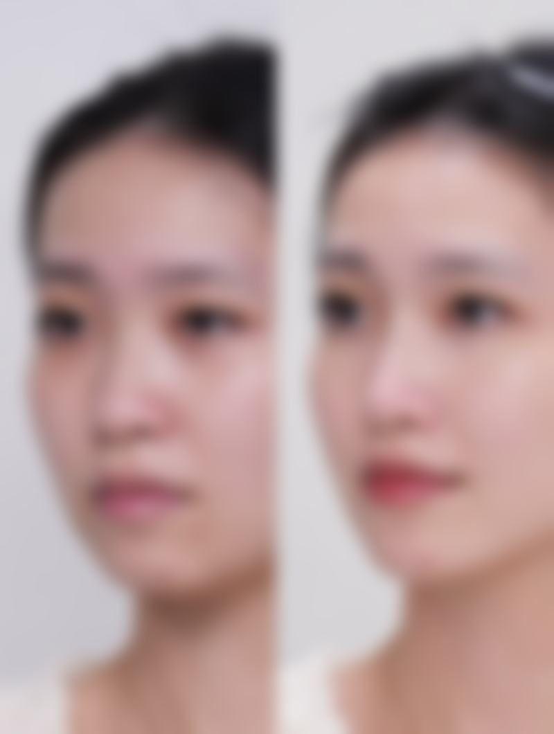 预约优惠活动