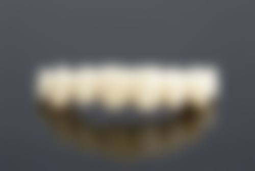 小产后多久可以补牙？答案因人而异，休息两天、半月、一月后等皆有可能，需结合恢复情况定！ 