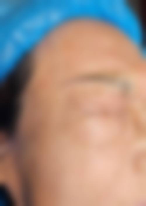 诊疗特色总结深圳呈悦医疗美容门诊部芭比亚沙维亚医生