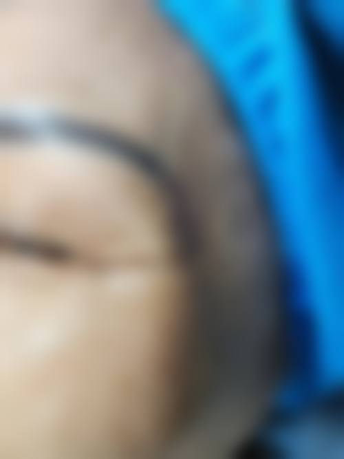 FAQ深圳呈悦医疗美容门诊部芭比亚沙维亚医生