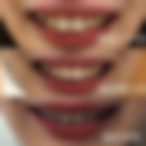 预约优惠活动