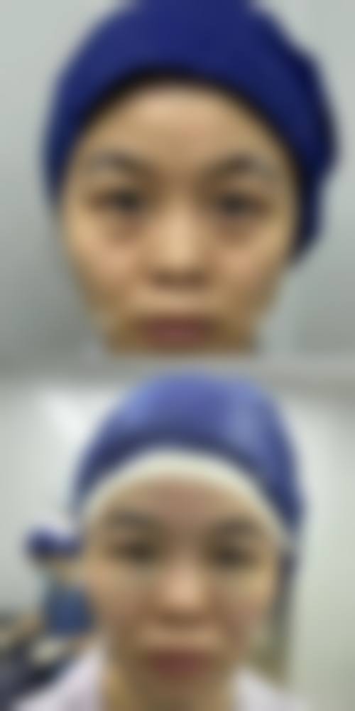 临床实例分享：治疗成效能否达到预期？
