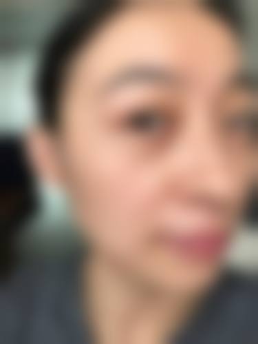 患者真实评价