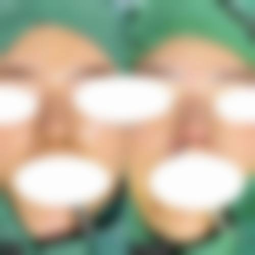 患者真实评价:南昌大学第二附属医院李小林医生口碑