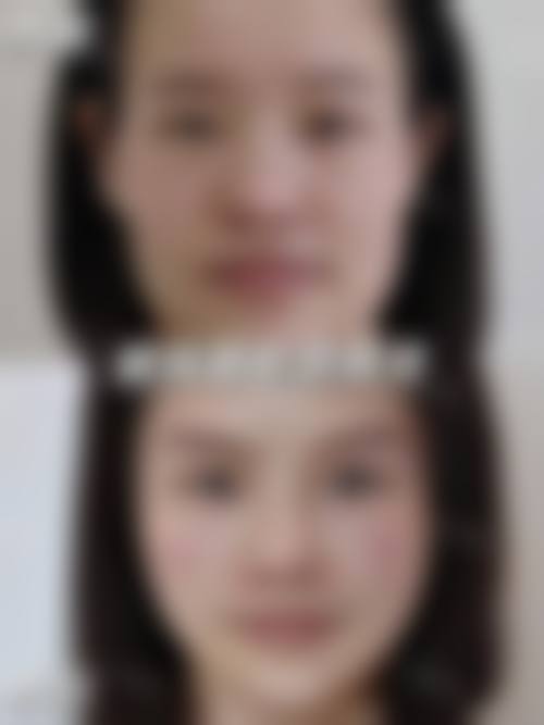 擅长项目详解