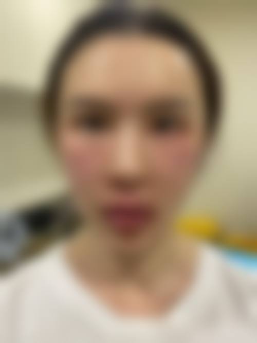 医生资质介绍深圳呈悦医疗美容门诊部芭比亚沙维亚医生