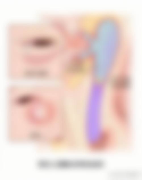 特色项目涵盖近视与复杂眼病