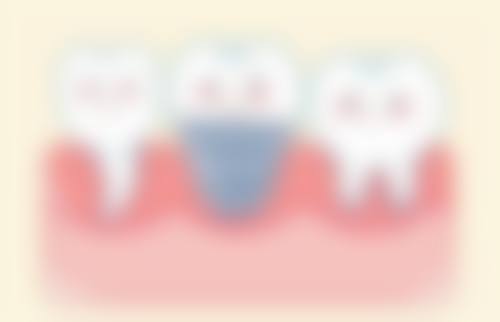 四、广州缪氏齿祖口腔特色项目