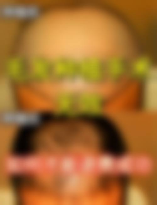 临床实例分享
