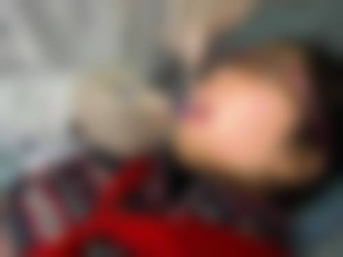 临床实例分享