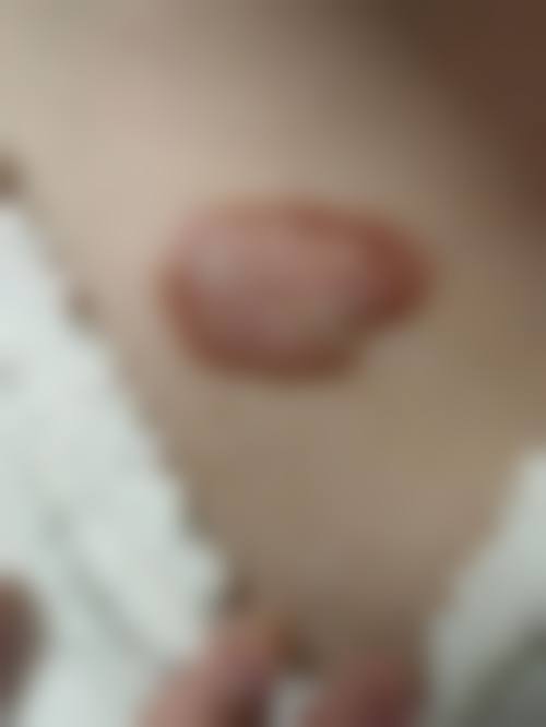 患者真实评价
