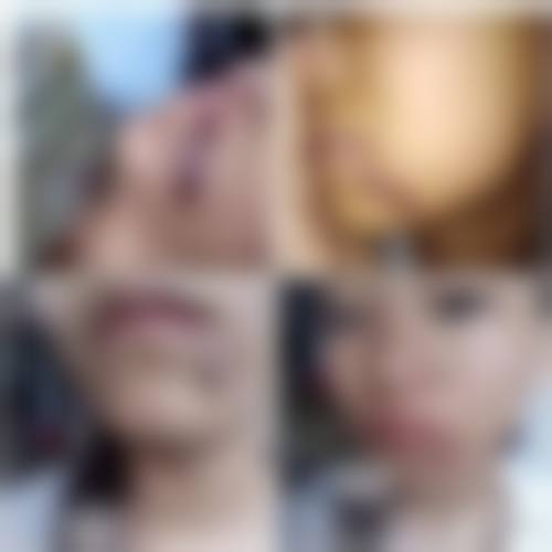 临床实例分享：芮小平医生擅长做我需要的项目吗？