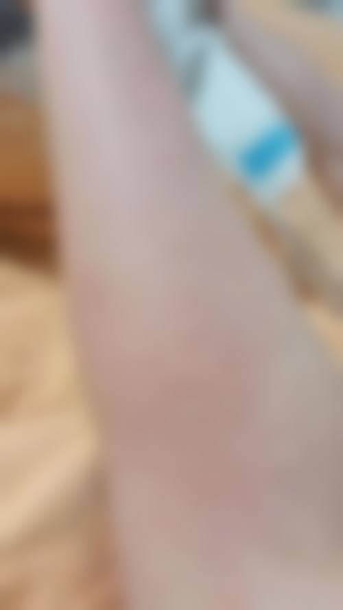 临床实例分享