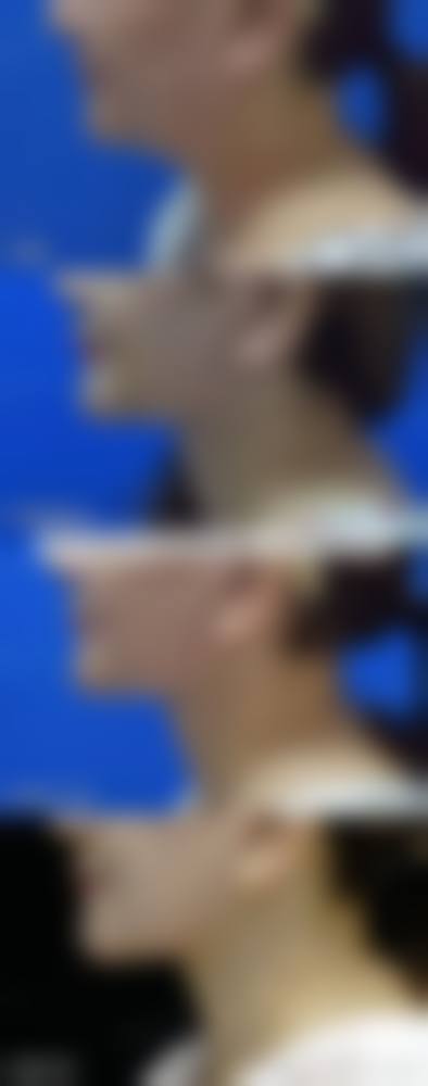 擅长项目详解