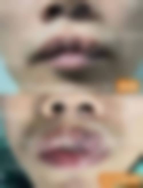 总结与预约指引