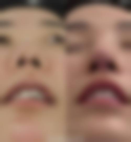患者真实评价