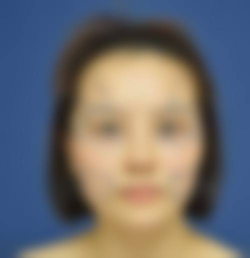 预约优惠活动：限时补贴不容错过