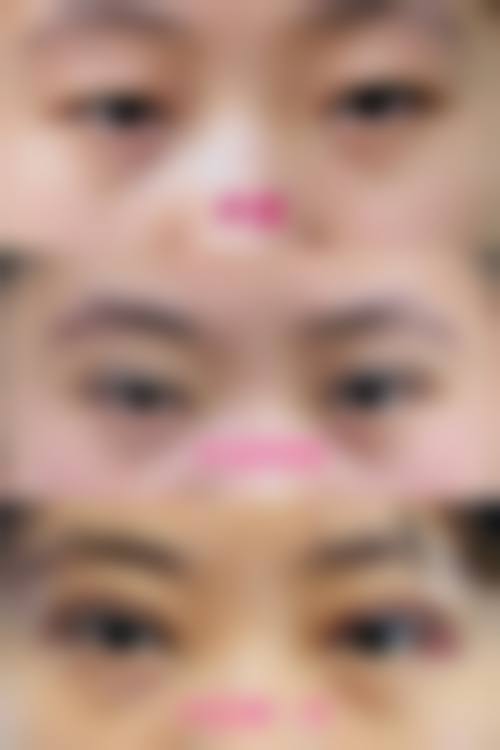 诊疗特色总结：芮小平+核心项目
