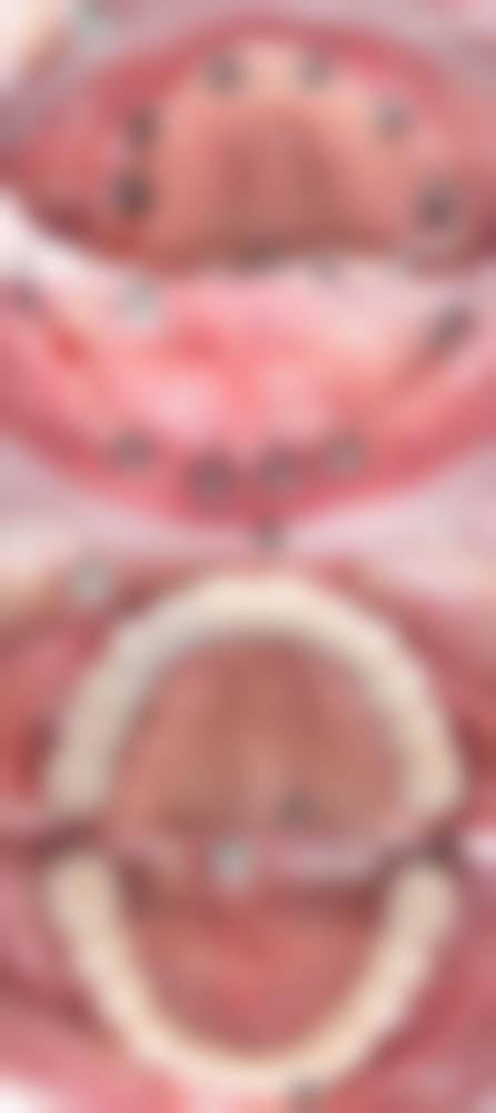 擅长项目详解：惠州致美口腔医院张舒然