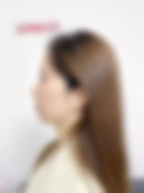 诊疗特色总结：惠州致美口腔医院张舒然