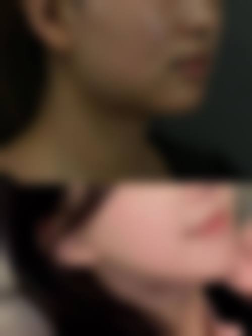 擅长项目详解：李得杓医生的核心技法