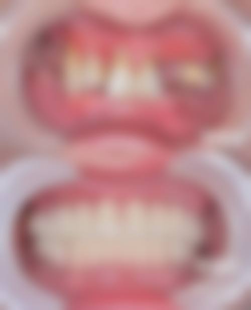 诊疗特色总结陕西瑞泰尔仓口腔医院吴文侠医生
