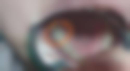 预约优惠活动:限时补贴不容错过