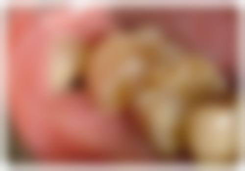 预约优惠活动:现在预约有什么补贴?