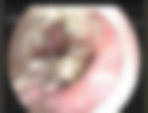 患者真实评价：口碑积累源于专精