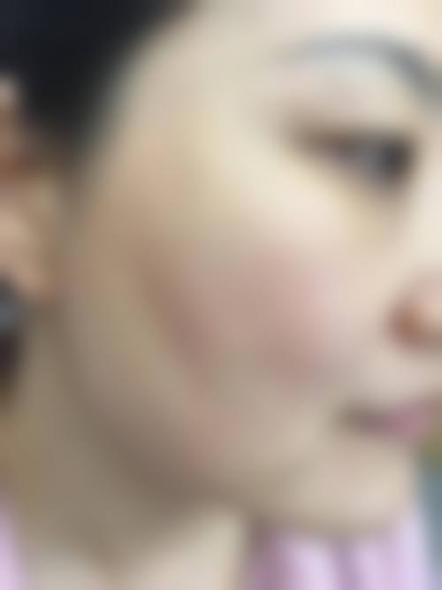患者真实评价：南昌大学第二附属医院廖洪跃