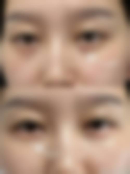 擅长项目详解东莞吉美中科医疗美容门诊部游凤军