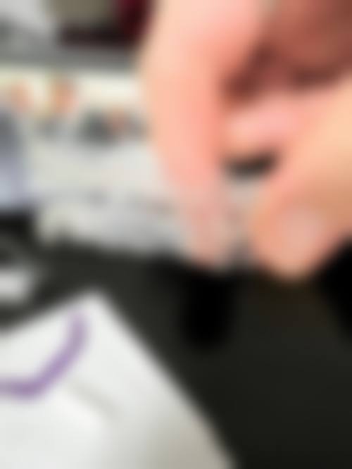 诊疗特色总结:细丝轻力与美学并重
