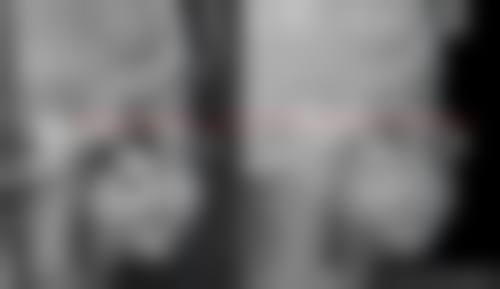 临床实例分享：吕春旭医生的治疗成效真实吗？