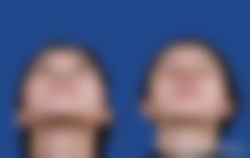 擅长项目详解