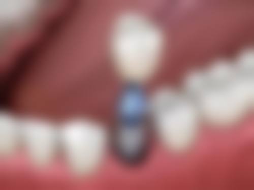 总结与到店预约指引